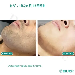 メンズ 【脱毛・美肌専門】 bellstyleのエステ・リラクイメージ