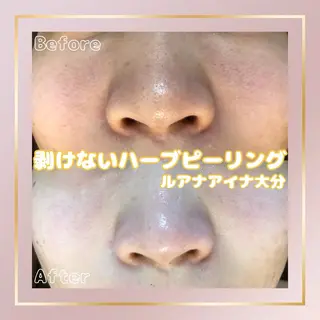 ルアナアイナ 大分のエステ・リラクイメージ