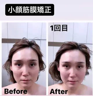 HAKUBI フェイシャルサロンのエステ・リラクイメージ