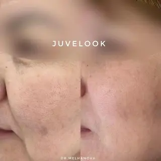 ネイル aliaハイフ&水光ジェットサロン所属・aliaハーブ水光店 エステティシャン募集のエステ・リラクイメージ