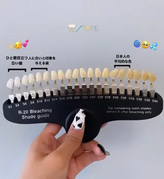 nanami -ホワイトニングのその他イメージ