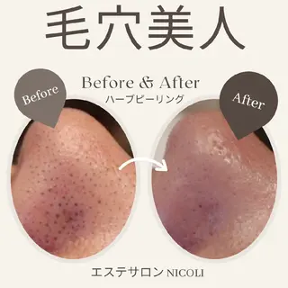 エステサロン NICOLIのエステ・リラクイメージ