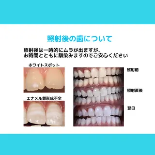ホワイトニング ショップ多摩店のその他イメージ