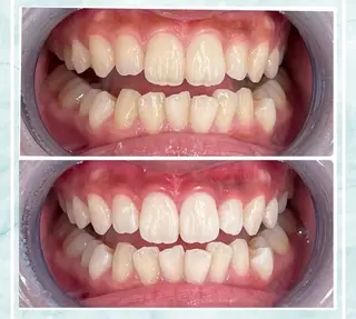 ホワイトニング ビューティ名古屋栄のその他イメージ