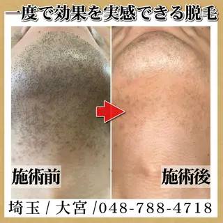 脱毛 TOWA大宮のエステ・リラクイメージ