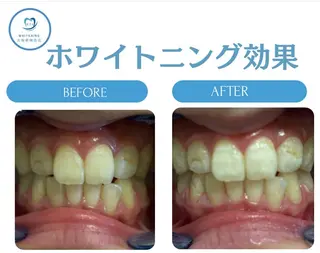 韓国式ホワイトニング R24大阪梅田店のその他イメージ