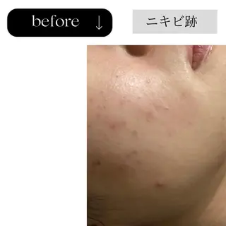 beauty CHOOSEのエステ・リラクイメージ