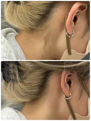 ◯△□所属・最新美肌脱毛 韓国水光肌🫧のその他イメージ