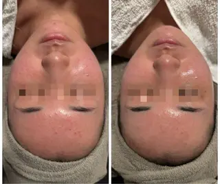 lumi riseのエステ・リラクイメージ