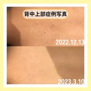 金山/脱毛/美肌 ULULUのエステ・リラクイメージ