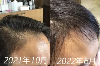 ショート エイジングケア特化 サーカス/育毛/スパのヘアスタイル