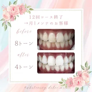 セルフホワイトニング Dolce八王子店のその他イメージ