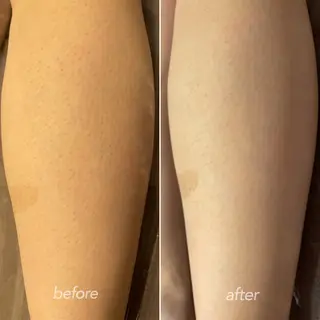 Tulipe所属・越野 Tulipe栄店のエステ・リラクイメージ