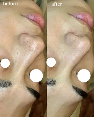 【都度払い専門】エステサロンARTI,天神大名店所属・【都度払い専門店】 エステサロARTI,のエステ・リラクイメージ