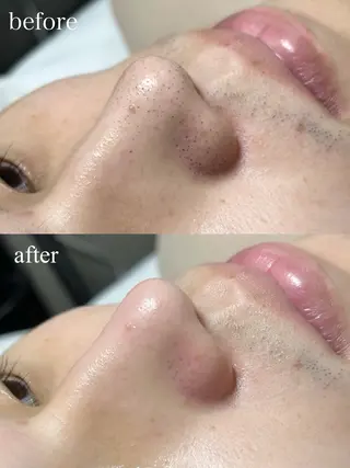 眉毛とまつ毛🫧 hinatsuの眉毛・アイブロウイメージ