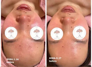 肌質改善専門店/絹々(きぬ)所属・心満たされる ハーブピーリング絹々のエステ・リラクイメージ