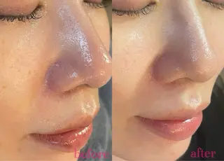 〚博多〛フィユ 水江のマツエク・マツパデザイン