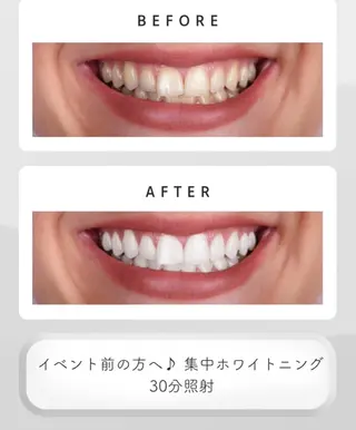 黒田 セルフホワイトニングのその他イメージ