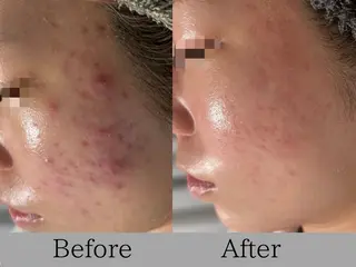 lumirise所属・lumi riseのエステ・リラクイメージ