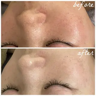 メンズ メナード岐阜市茜部 杉浦のエステ・リラクイメージ