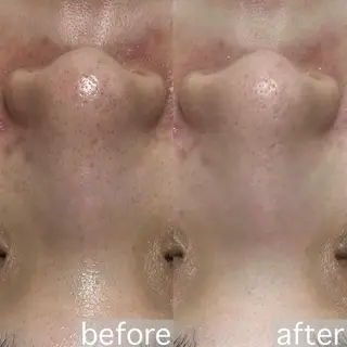 WAX脱毛/肌質改善 眉毛とお肌のサロンのエステ・リラクイメージ