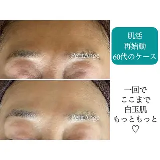 艶肌&小顔リフト❤︎ プチアンジェ茅ヶ崎のエステ・リラクイメージ