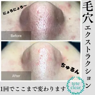 beauty salonWのエステ・リラクイメージ