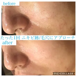 ロング カラー パーマ ヘアアレンジ キッズ ネイル マツエク・マツパ EnsorClair 代表 野口真央のエステ・リラクイメージ