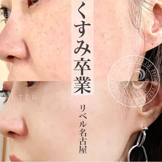 マツエク・マツパ 次世代まつげパーマは 『リベル名古屋』のマツエク・マツパデザイン