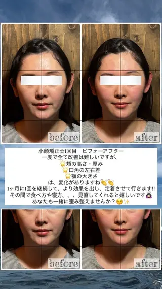 💎後悔させない小顔 矯正💎イトヤマ🌱のエステ・リラクイメージ