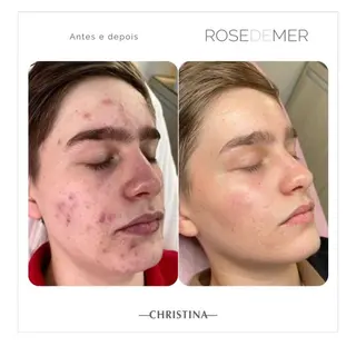 ROOM.S ｜脱毛｜美肌｜ボディのエステ・リラクイメージ