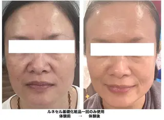 デトックスリンパ・ ヘッドスパ・痩身のエステ・リラクイメージ