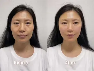 ネイル aliaハーブ水光店 エステティシャン募集のエステ・リラクイメージ