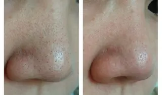 プライベートサロン LaLa 北山まいこのエステ・リラクイメージ