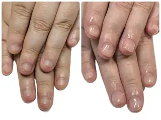 ネイル 深爪矯正・自爪育成 ヴェールリムのネイルデザイン