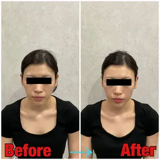 小顔矯正・美容鍼 FLOW鍼灸整体院のエステ・リラクイメージ