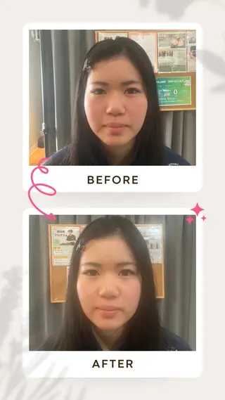 健康×美容鍼鍼灸院 あさば整体院三ノ輪店のエステ・リラクイメージ