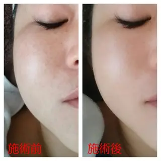 本気の痩身🕊渡邊 明子🕊のその他イメージ