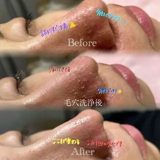 🫧美しい素肌へ🫧 今成柚乃のその他イメージ