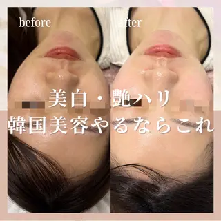 🎀韓国式肌改善🎀 Miku🇰🇷💎のエステ・リラクイメージ