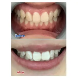 M渋谷 ホワイトニングのエステ・リラクイメージ