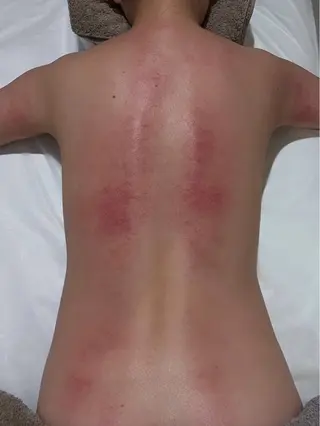 LibCharm🩰 村山美咲のエステ・リラクイメージ