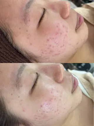 BeautySalo nCielChibaのエステ・リラクイメージ