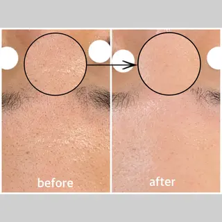 韓国肌管理 【毛穴専科】のエステ・リラクイメージ