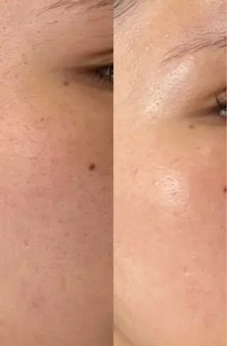 ナリス ビューティーステーション デ・アイム 有田所属・西谷 ゆめのエステ・リラクイメージ