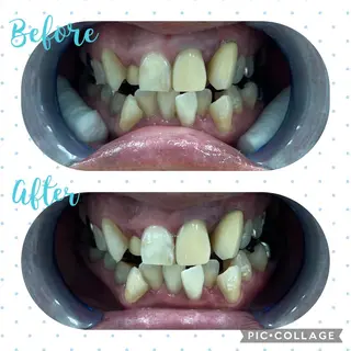 セルフホワイトニング COCOSHIROのエステ・リラクイメージ