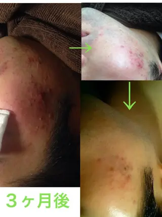 メンズ 朝重い人専用 肩甲骨調整のエステ・リラクイメージ