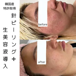 歌舞伎町深夜サロン to mëのエステ・リラクイメージ