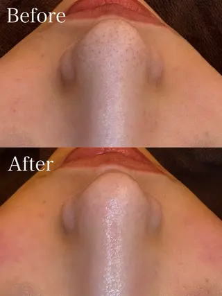 🤍アベシュリ /フェイシャル🤍のエステ・リラクイメージ