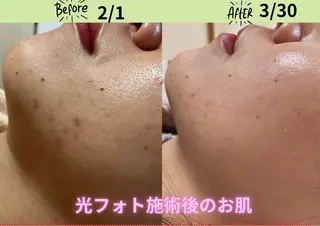 LUMINAルミナ 【肌管理サロン】のその他イメージ